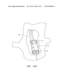 PROSTHETIC HEART VALVES, SCAFFOLDING STRUCTURES, AND SYSTEMS AND METHODS     FOR IMPLANTING OF SAME diagram and image