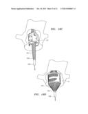 PROSTHETIC HEART VALVES, SCAFFOLDING STRUCTURES, AND SYSTEMS AND METHODS     FOR IMPLANTING OF SAME diagram and image