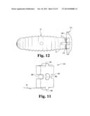 INTERBODY SPINAL IMPLANTS WITH EXTRAVERTEBRAL SUPPORT PLATES diagram and image