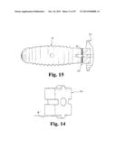 INTERBODY SPINAL IMPLANTS WITH EXTRAVERTEBRAL SUPPORT PLATES diagram and image