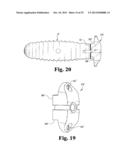 INTERBODY SPINAL IMPLANTS WITH EXTRAVERTEBRAL SUPPORT PLATES diagram and image