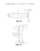 INTERBODY SPINAL IMPLANTS WITH EXTRAVERTEBRAL SUPPORT PLATES diagram and image