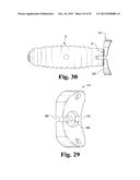 INTERBODY SPINAL IMPLANTS WITH EXTRAVERTEBRAL SUPPORT PLATES diagram and image