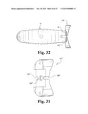 INTERBODY SPINAL IMPLANTS WITH EXTRAVERTEBRAL SUPPORT PLATES diagram and image