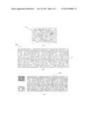 BONE GRAFT diagram and image