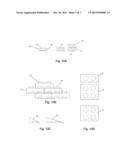 BONE GRAFT diagram and image