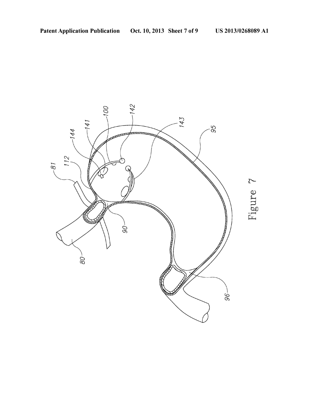 ADAPTER FOR STOMACH DEVICES - diagram, schematic, and image 08