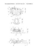 ACTUATED LEG PROSTHESES FOR AMPUTEES diagram and image