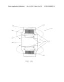 ACTUATED LEG PROSTHESES FOR AMPUTEES diagram and image