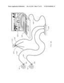 METHOD, SYSTEM, AND APPARATUS FOR AIMING LED LIGHTING diagram and image