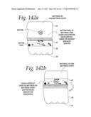 FOUR-IN-ONE MATTRESS MANAGEMENT SYSTEM diagram and image