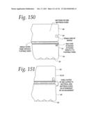 FOUR-IN-ONE MATTRESS MANAGEMENT SYSTEM diagram and image