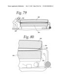 FOUR-IN-ONE MATTRESS MANAGEMENT SYSTEM diagram and image