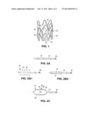 METHODS FOR IMPROVING STENT RETENTION ON A BALLOON CATHETER diagram and image