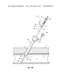 SEALANT MIXING CONTAINERS FOR EXTRA VASCULAR BIOADHESIVE DELIVERY SYSTEMS     AND METHODS diagram and image