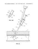 SEALANT MIXING CONTAINERS FOR EXTRA VASCULAR BIOADHESIVE DELIVERY SYSTEMS     AND METHODS diagram and image