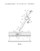 SEALANT MIXING CONTAINERS FOR EXTRA VASCULAR BIOADHESIVE DELIVERY SYSTEMS     AND METHODS diagram and image