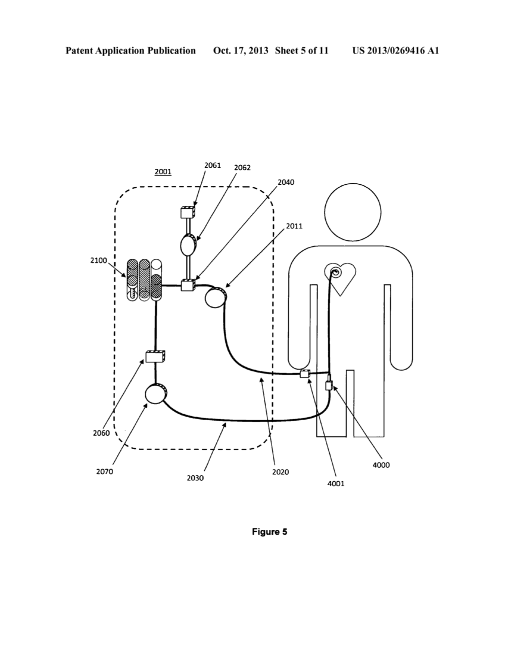 Method and device for combined measurement of bubbles and flow rate in a     system for enriching a bodily fluid with a gas - diagram, schematic, and image 06