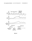 POSITIVE PRESSURE SYSTEMS AND METHODS FOR INCREASING BLOOD PRESSURE AND     CIRCULATION diagram and image