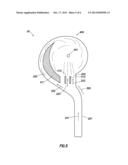 METHOD OF SIMULTANEOUSLY STIMULATING MULTIPLE ZONES OF A FORMATION USING     FLOW RATE RESTRICTORS diagram and image