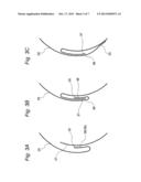 CONDUCTING LINE SHIELD STRUCTURE diagram and image