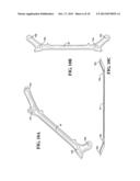 SUBFRAME INTRUSION CONTROL BY STEERING GEAR CATCHER diagram and image