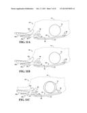 SUBFRAME INTRUSION CONTROL BY STEERING GEAR CATCHER diagram and image