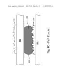 3D Packaging With Low-Force Thermocompression Bonding Of Oxidizable     Materials diagram and image