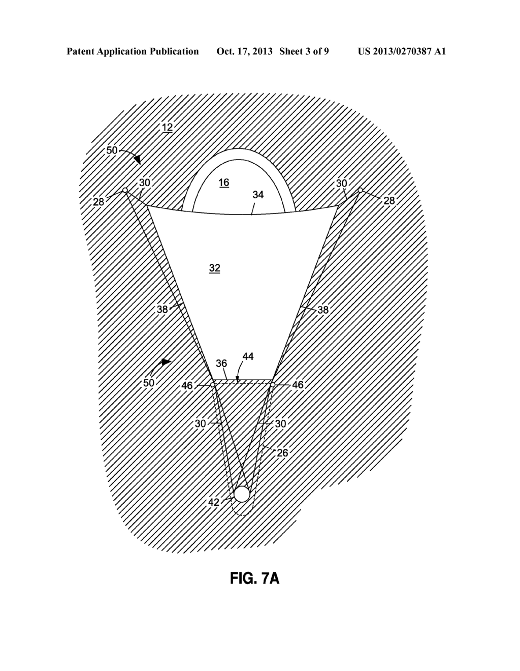 SYSTEM AND METHOD FOR FURLING AN AIR CUSHION LANDING SYSTEM - diagram, schematic, and image 04