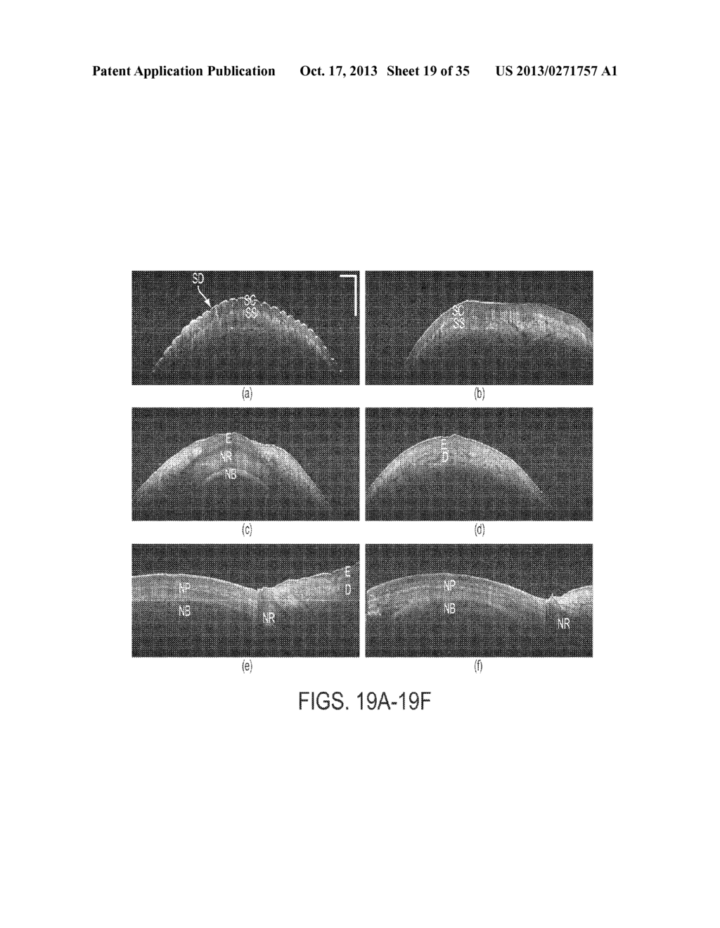 REAL-TIME, THREE-DIMENSIONAL OPTICAL COHERENCE TOMOGRAPNY SYSTEM - diagram, schematic, and image 20