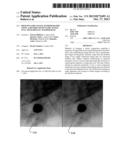 High Dynamic Range Mammography Using a Restricted Dynamic Range Full Field     Digital Mammogram diagram and image