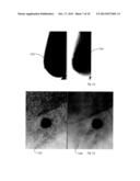 High Dynamic Range Mammography Using a Restricted Dynamic Range Full Field     Digital Mammogram diagram and image