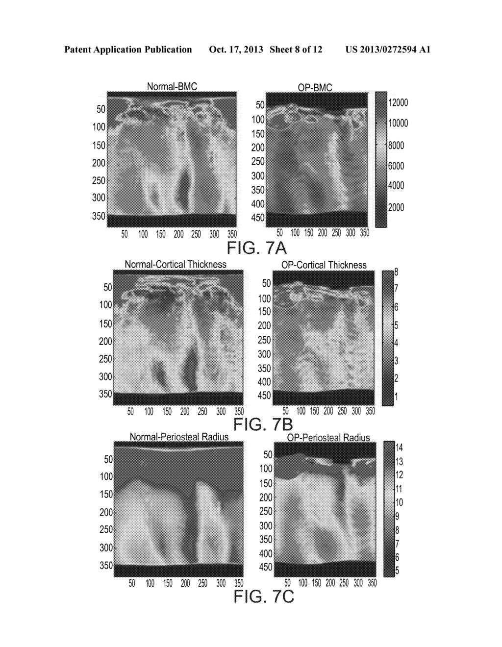 METHOD AND SYSTEM OF IMAGING AND/OR DIAGNOSING A BONE FROM A RECONSTRUCTED     VOLUME IMAGE - diagram, schematic, and image 09