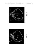 METHODS FOR GENERATING A RECONSTRUCTED TREE STRUCTURE FROM MEDICAL IMAGE     DATA diagram and image