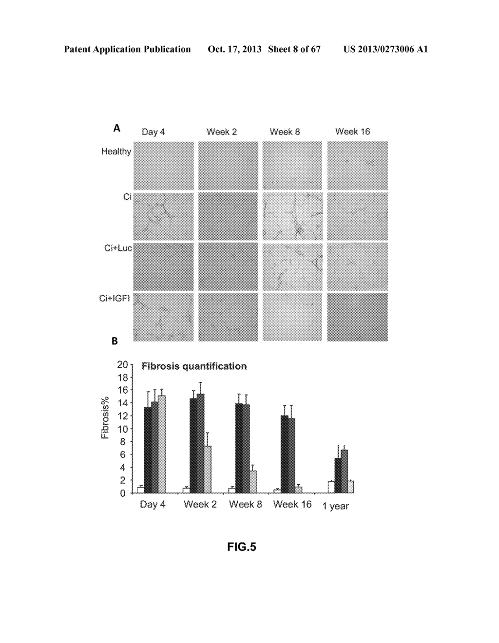 METHODS AND COMPOSITIONS FOR THE TREATMENT OF CIRRHOSIS AND LIVER FIBROSIS - diagram, schematic, and image 09