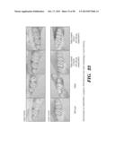 PREPARATION OF ISOLATED AGONIST ANTI-EDAR MONOCLONAL ANTIBODIES diagram and image