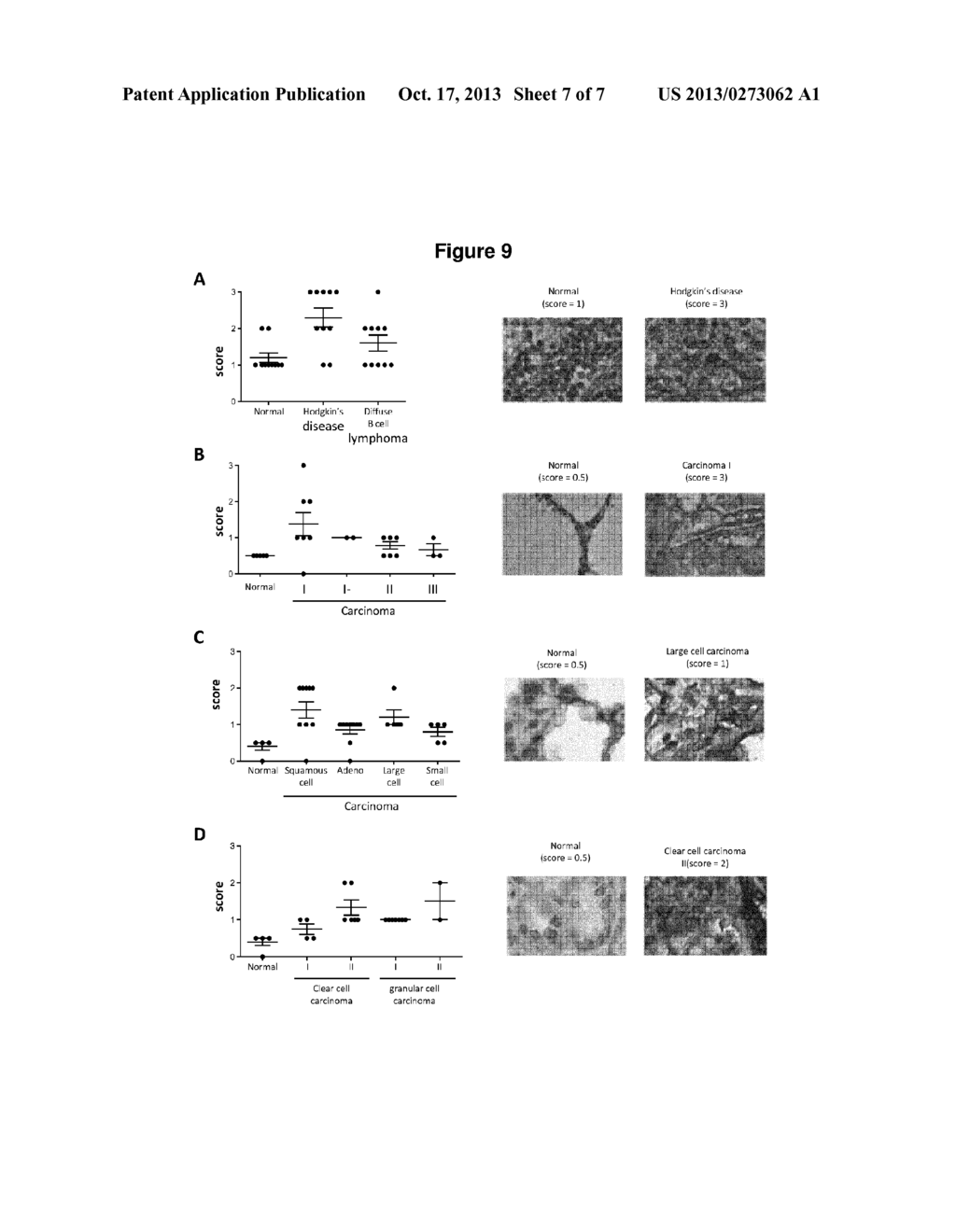 ANTIBODIES AGAINST HUMAN CD39 AND USE THEREOF - diagram, schematic, and image 08