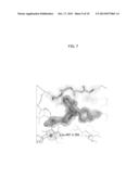 METHODS AND KITS TO PREDICT THERAPEUTIC OUTCOME OF BTK INHIBITORS diagram and image