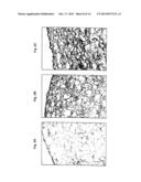 SYSTEMS FOR CARTILAGE REPAIR diagram and image