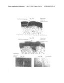 SYSTEMS FOR CARTILAGE REPAIR diagram and image