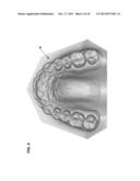SYSTEM AND METHOD FOR EVALUATING ORTHODONTIC TREATMENT diagram and image