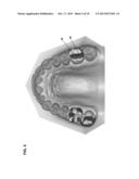 SYSTEM AND METHOD FOR EVALUATING ORTHODONTIC TREATMENT diagram and image