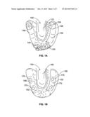 System and Method for Improved Intra-Oral Scanning Protocol and     Calibration diagram and image