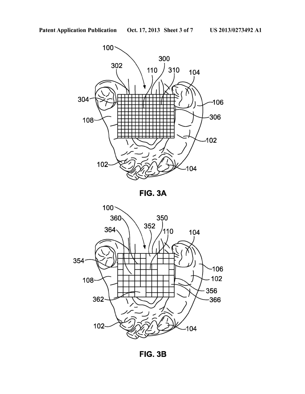 System and Method for Improved Intra-Oral Scanning Protocol and     Calibration - diagram, schematic, and image 04