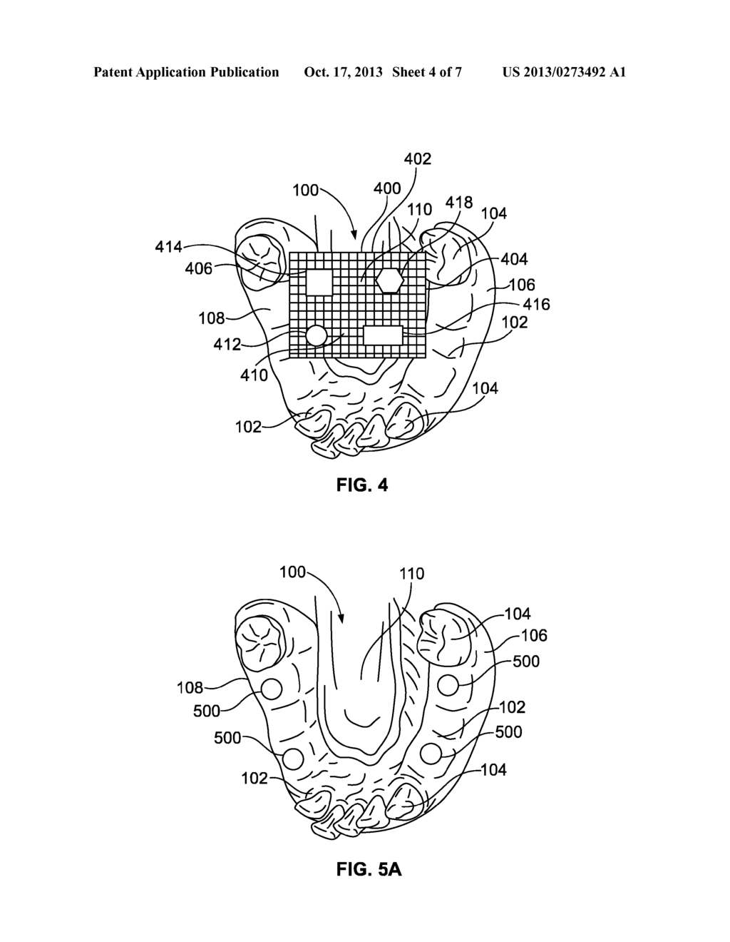 System and Method for Improved Intra-Oral Scanning Protocol and     Calibration - diagram, schematic, and image 05