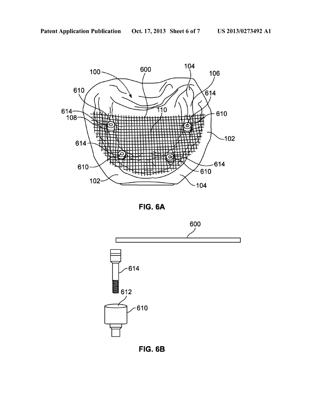 System and Method for Improved Intra-Oral Scanning Protocol and     Calibration - diagram, schematic, and image 07