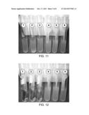 DENTAL PROBE, A METHOD OF FORMING THE PROBE AND A METHOD OF USING THE     PROBE diagram and image