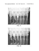 DENTAL PROBE, A METHOD OF FORMING THE PROBE AND A METHOD OF USING THE     PROBE diagram and image