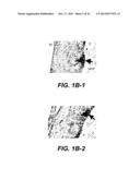 UPREGULATION OF RACK-1 IN MELANOMA AND ITS USE AS A MARKER diagram and image