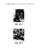 UPREGULATION OF RACK-1 IN MELANOMA AND ITS USE AS A MARKER diagram and image